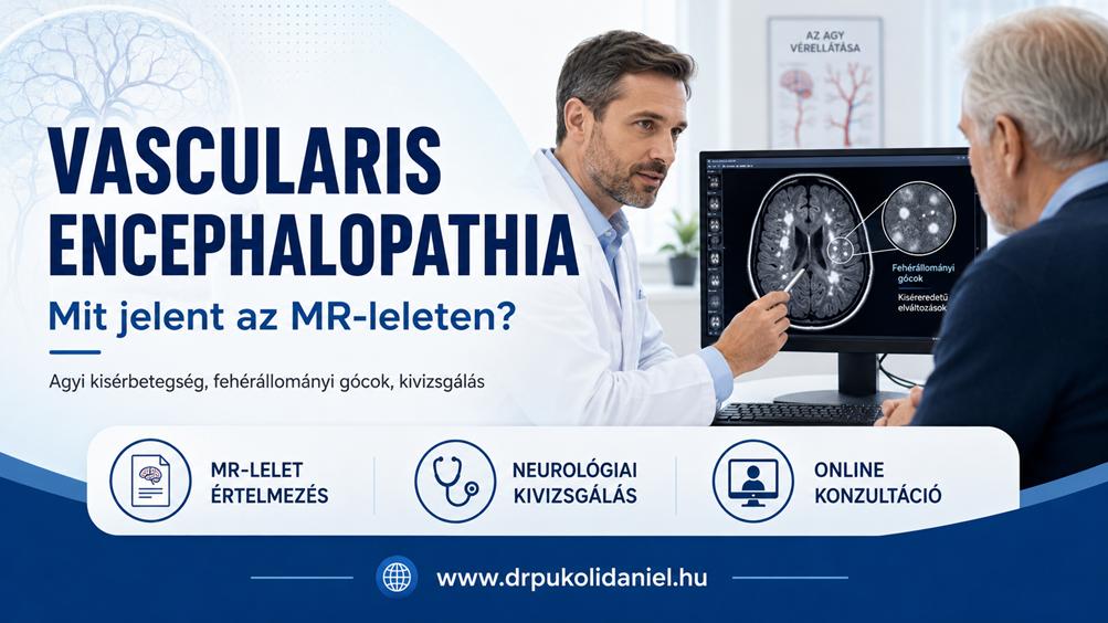 Vascularis encephalopathia MR-lelet értelmezése neurológiai konzultáción